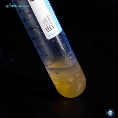 50 मिलीलीटर पीआरपी ट्यूब किट ऊतकों को बनाए रखती है पर्यावरण संतुलन प्लेटलेट रिच प्लाज्मा किट